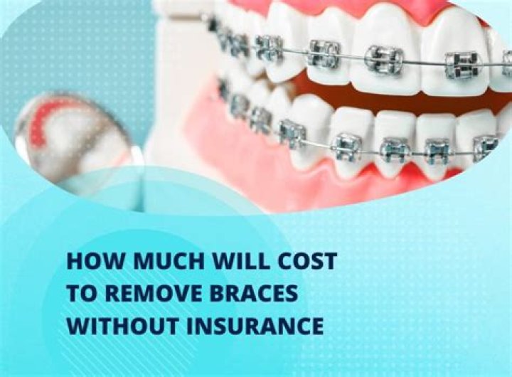 Are braces a necessary medical expense?
