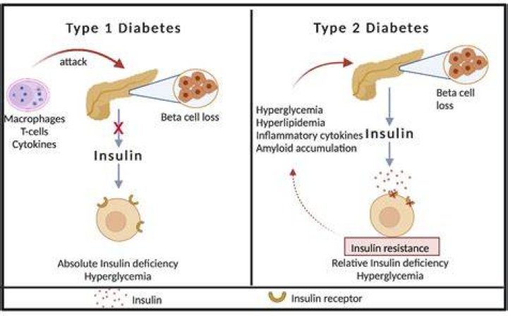 Are Type 2 diabetics insulin dependent?