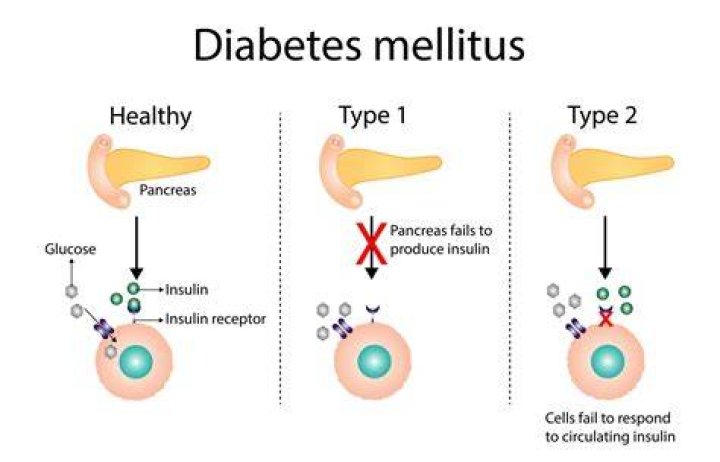 Can you develop diabetes from medication?