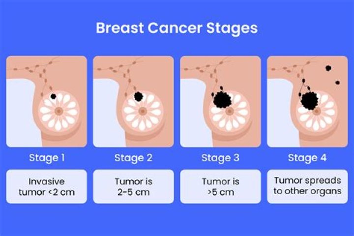 Can you get breast cancer at 68?