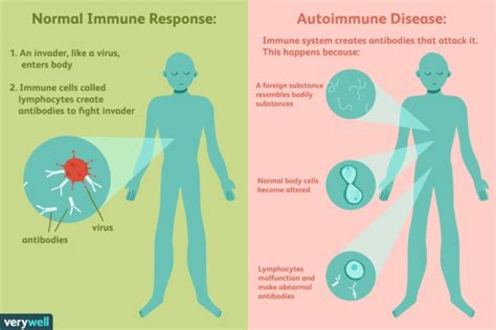 Does an immunologist treat autoimmune diseases?