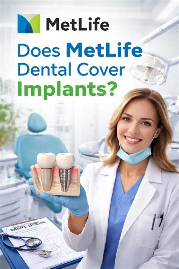 Does MetLife cover implants?