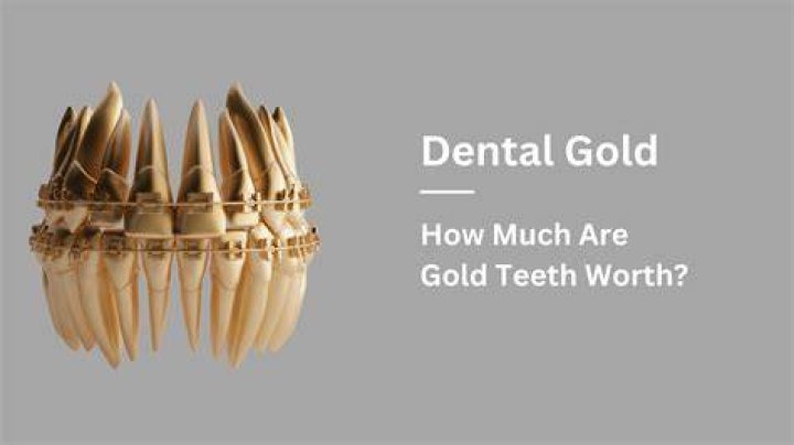 How do I know what my gold is worth?