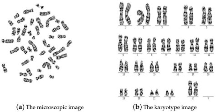 How do scientists make a karyotype?