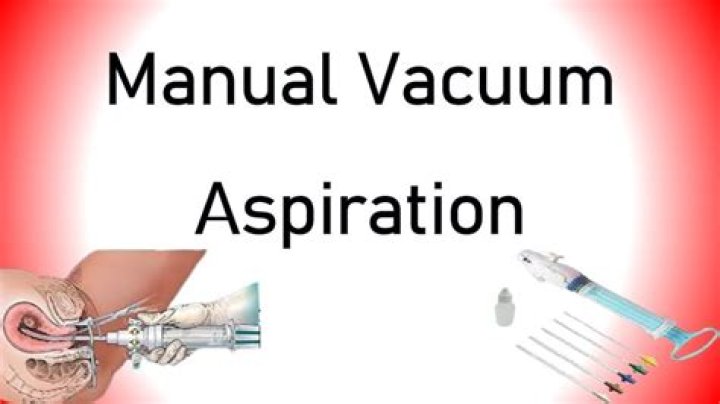How is a aspiration done?
