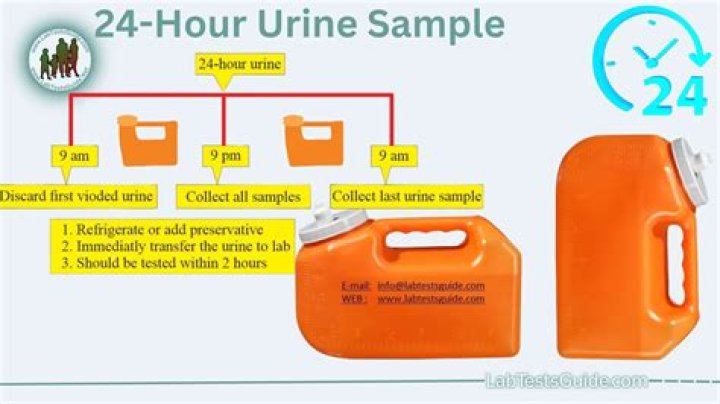 How many hours can urine be stored?