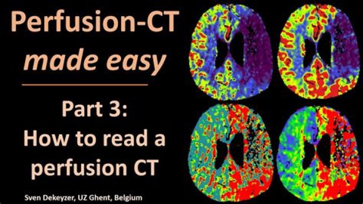 How much does a perfusion tech make?
