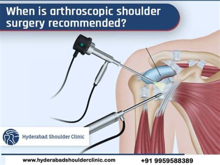 How much is a shoulder surgery settlement worth?