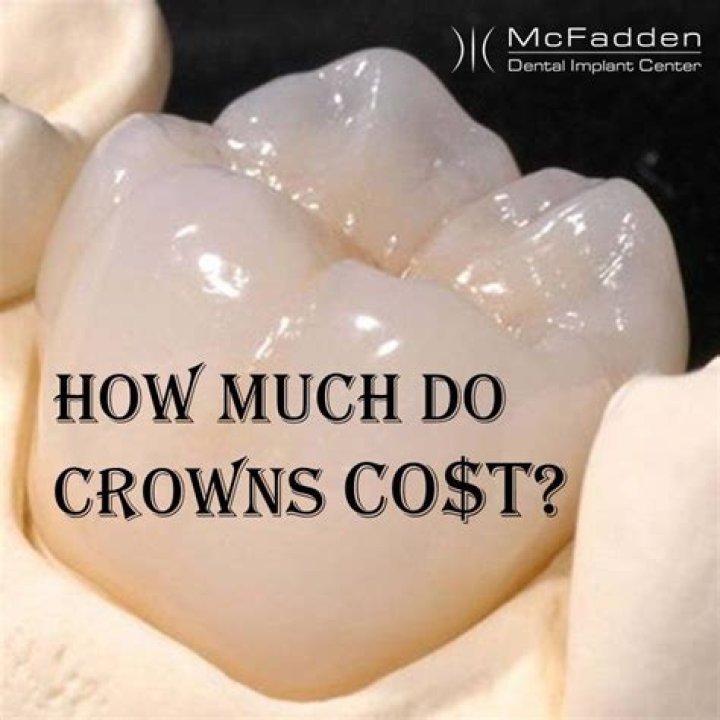 How much is a tooth crown worth?