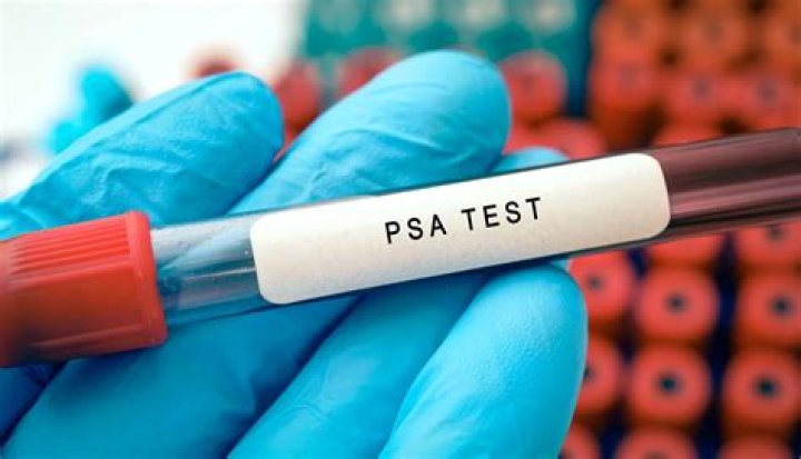 How much should a PSA blood test cost?