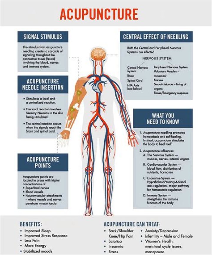Is acupuncture a qualified medical expense?