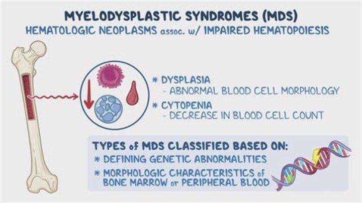Is gold plastic Syndrome still around?