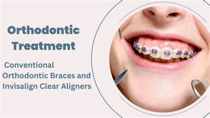 Is orthodontia covered?