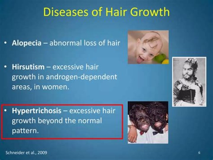 What causes excessive hair pulling?