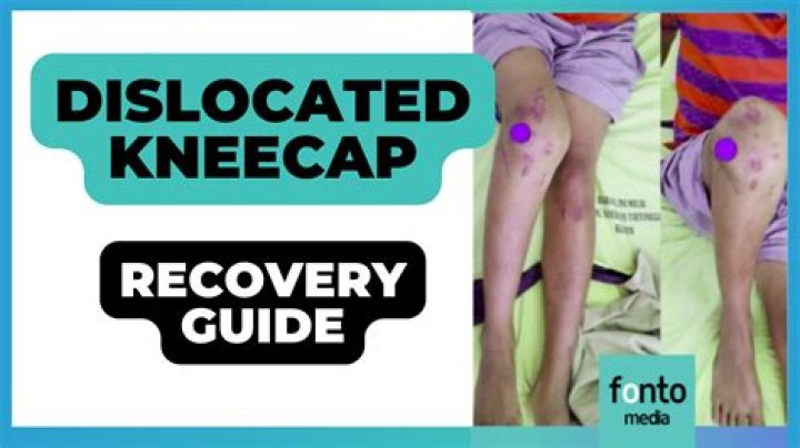 What happens when knee cap is removed?
