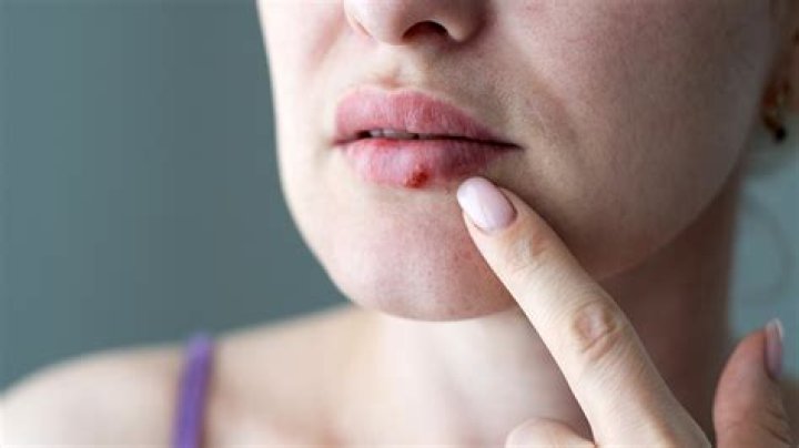 What happens when you shake hands with someone who has a cold?