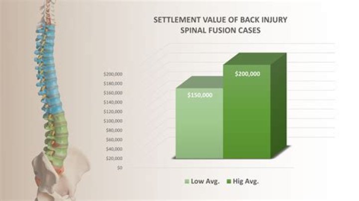 What is the average settlement for back surgery?