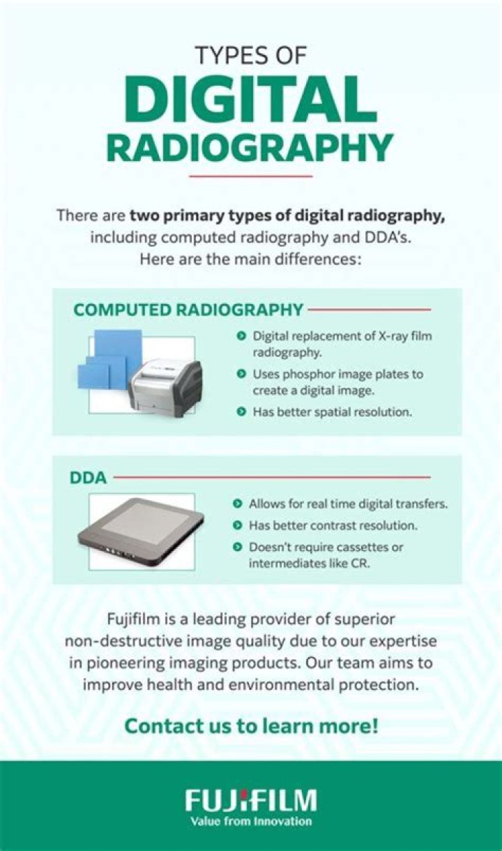 What is the difference between a conventional radiography and digital radiography?