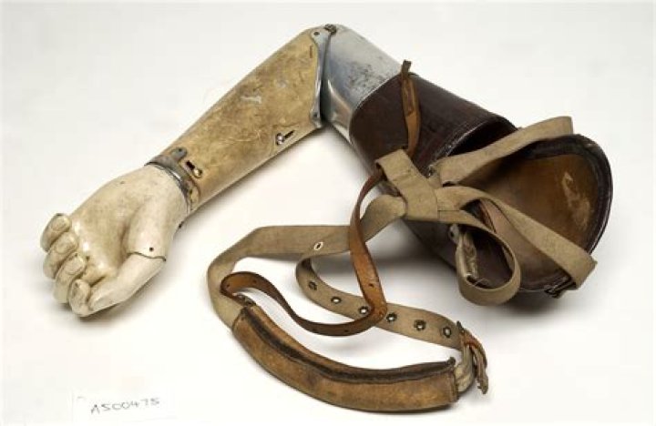 What was the most significant advancement made in prosthetics during the Civil War who was responsible for making it?