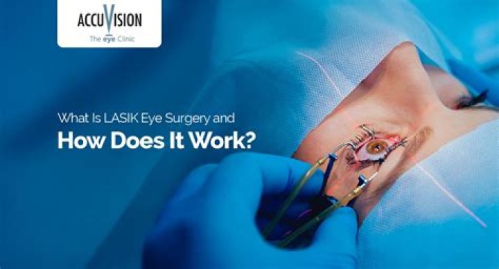 What will be the cost for LASIK eye surgery?