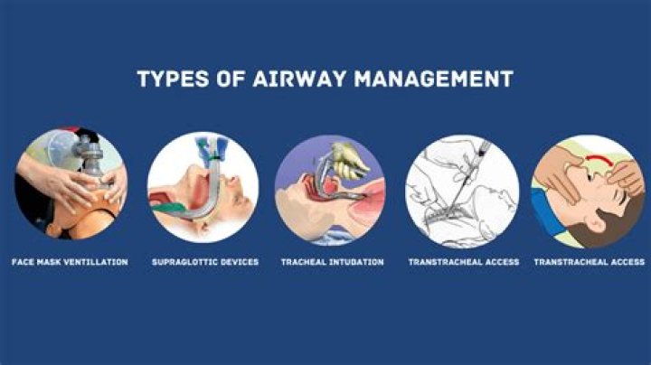 When would you provide airway management to a patient?