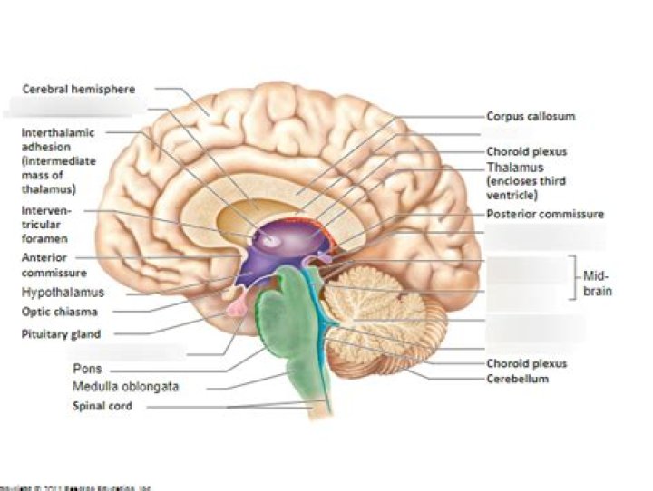 Which part of the brain contains the arbor vitae quizlet?