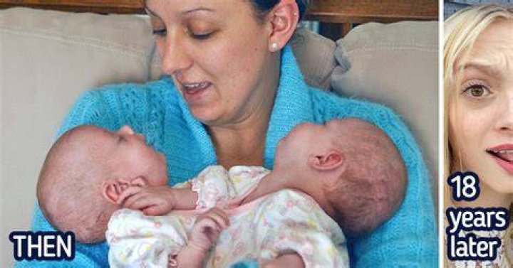 Who are the twins who were separated at birth?