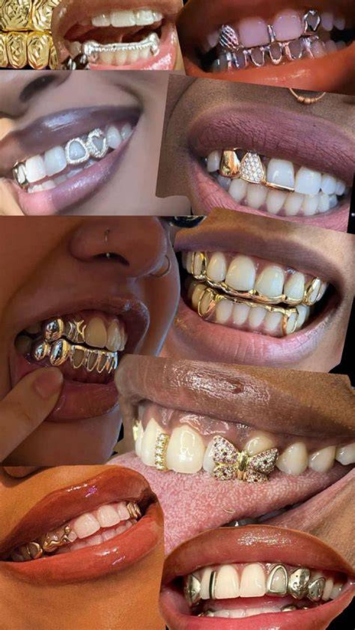 Why do Islanders have gold teeth?