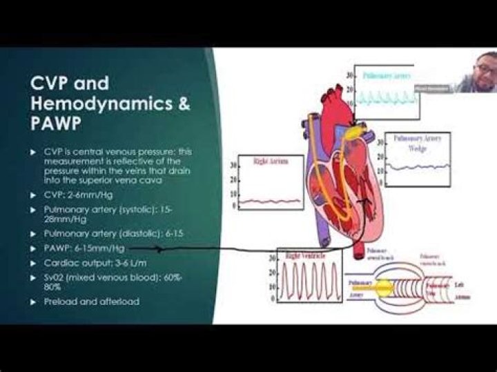 Why is it important for managers to understand CVP relationship?