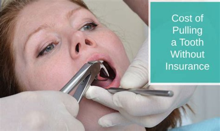 Will a dentist pull a tooth without insurance?