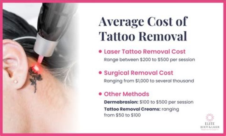 Will most insurance companies cover the cost of Tattoo removal?